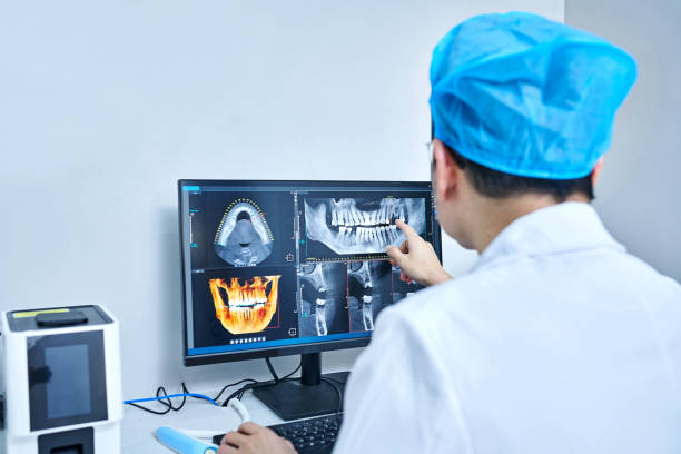 Best Knocked-Out Tooth (Avulsed Tooth) Treatment in Alderson, WV