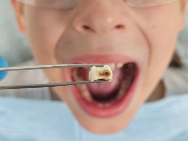 Best Emergency Orthodontic Repairs in Alderson, WV